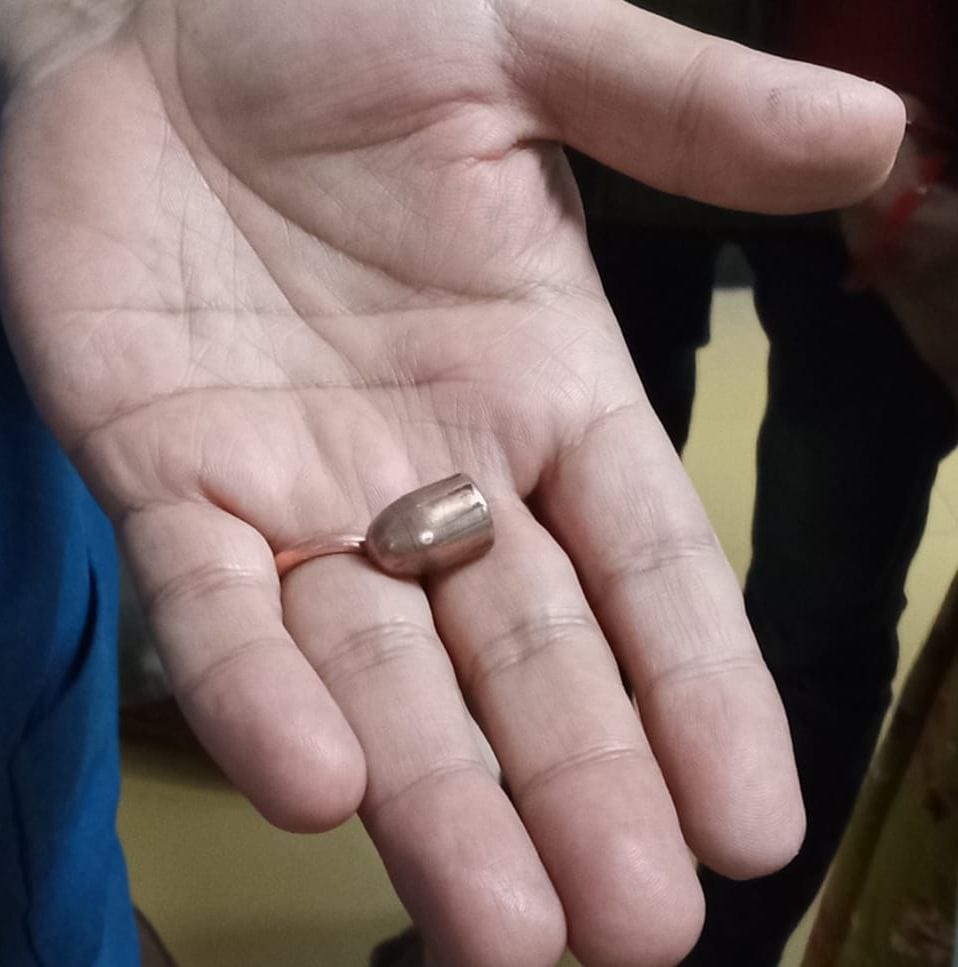 अस्पताल में भर्ती लक्ष्मी व उसके सिर से निकाली गई गोली।