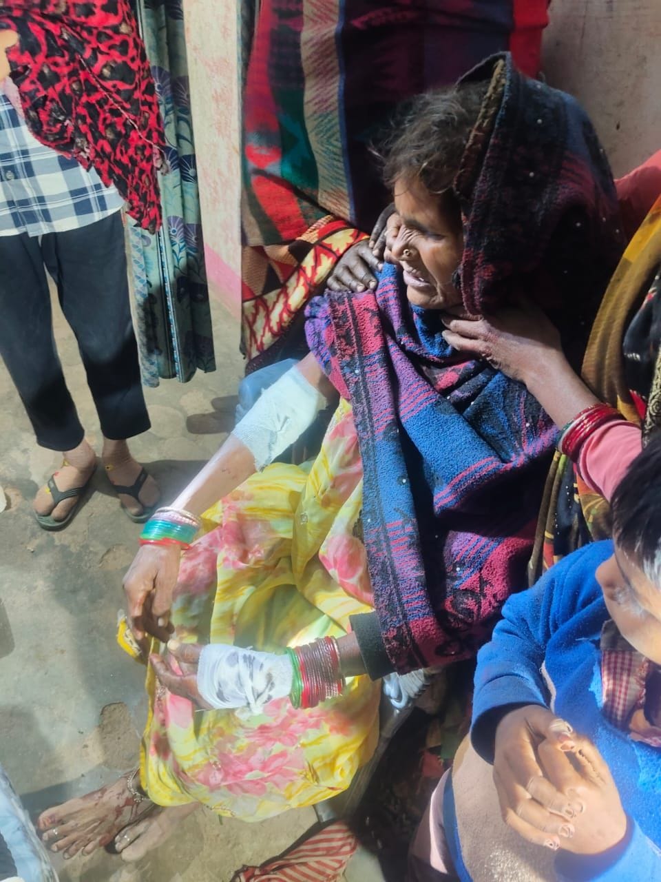 फोटो-37- लकड़बग्घे के हमले में घायल महिला। संवाद