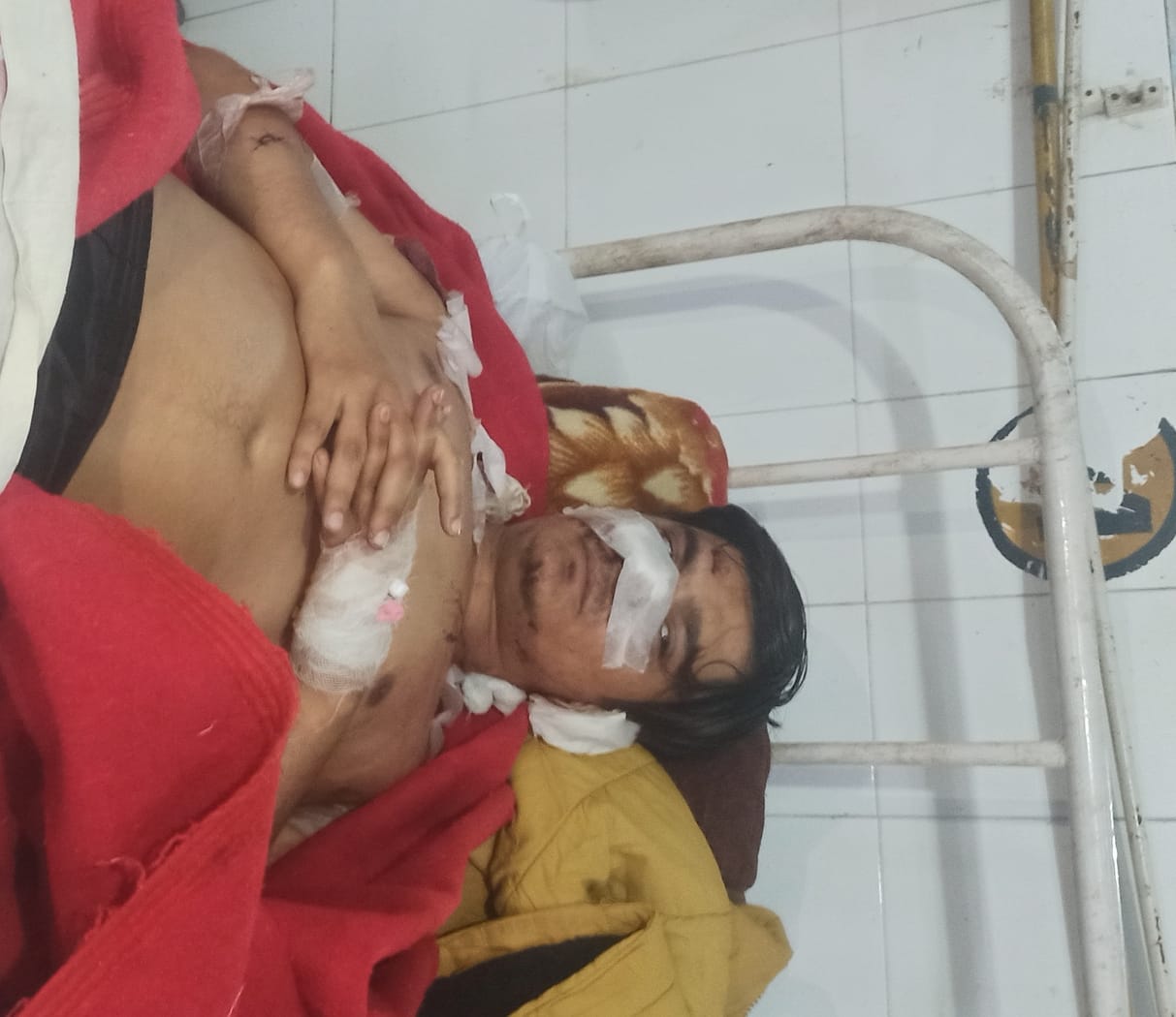 फोटो-07-जिला अस्पताल में भर्ती आमिर। स्रोत वीडियो फोटो-07-जिला अस्पताल में भर्ती आमिर। स्रोत वीडियो