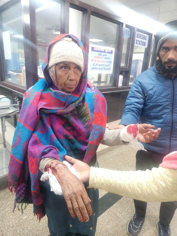 कुरुक्षेत्र। अस्पताल पहुंचने पर कुत्ते के काटने से हुए जख्म दिखाते रामचंद्र। संवाद