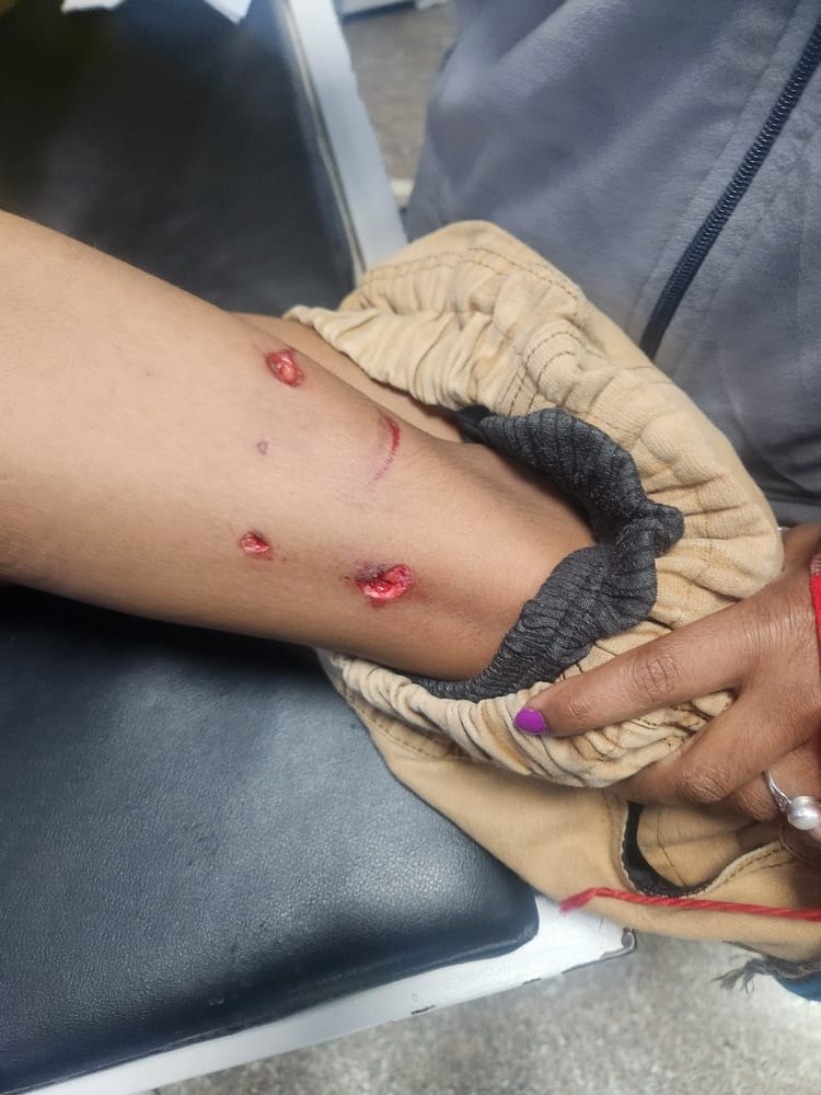 कुरुक्षेत्र। अस्पताल पहुंचने पर कुत्ते के काटने से हुए जख्म दिखाते रामचंद्र। संवाद