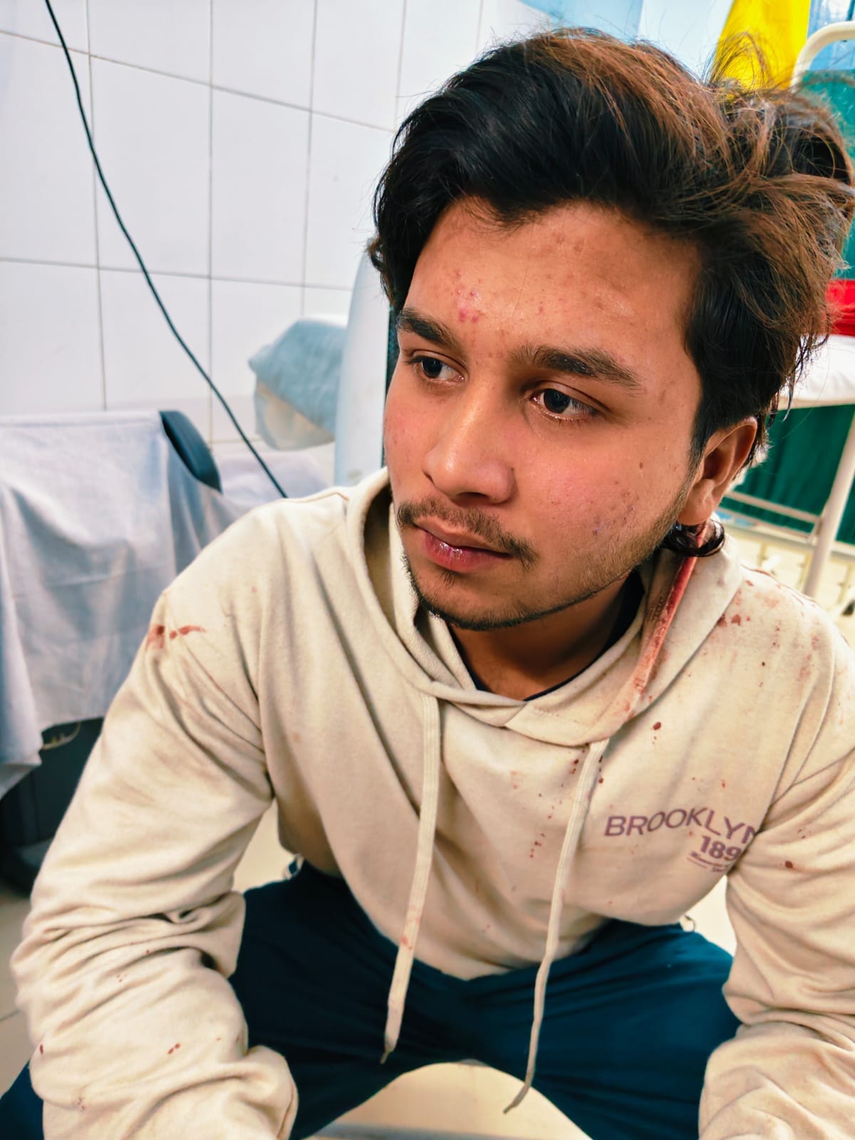 सरधना। मोहल्ला भुलरिया में पथराव में घायल शान। संवाद
