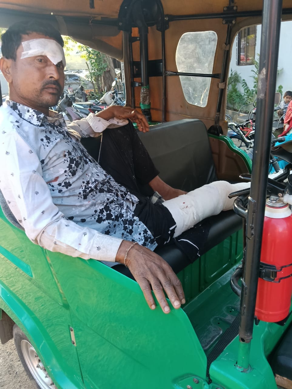 आरोपी धमकी देते हुए, घायलों की बाइट व एक्टिवा में आग 