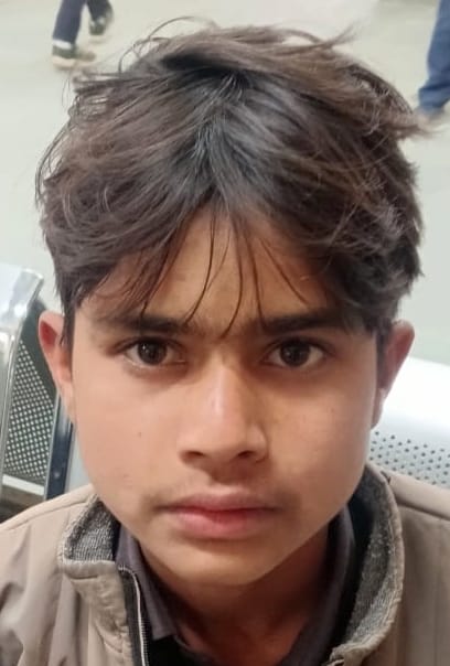 मीरानपुर कटरा में बन्दर के हमले में घायल तान्या। संवाद मीरानपुर कटरा में बन्दर के हमले में घायल तान्या। संवाद
