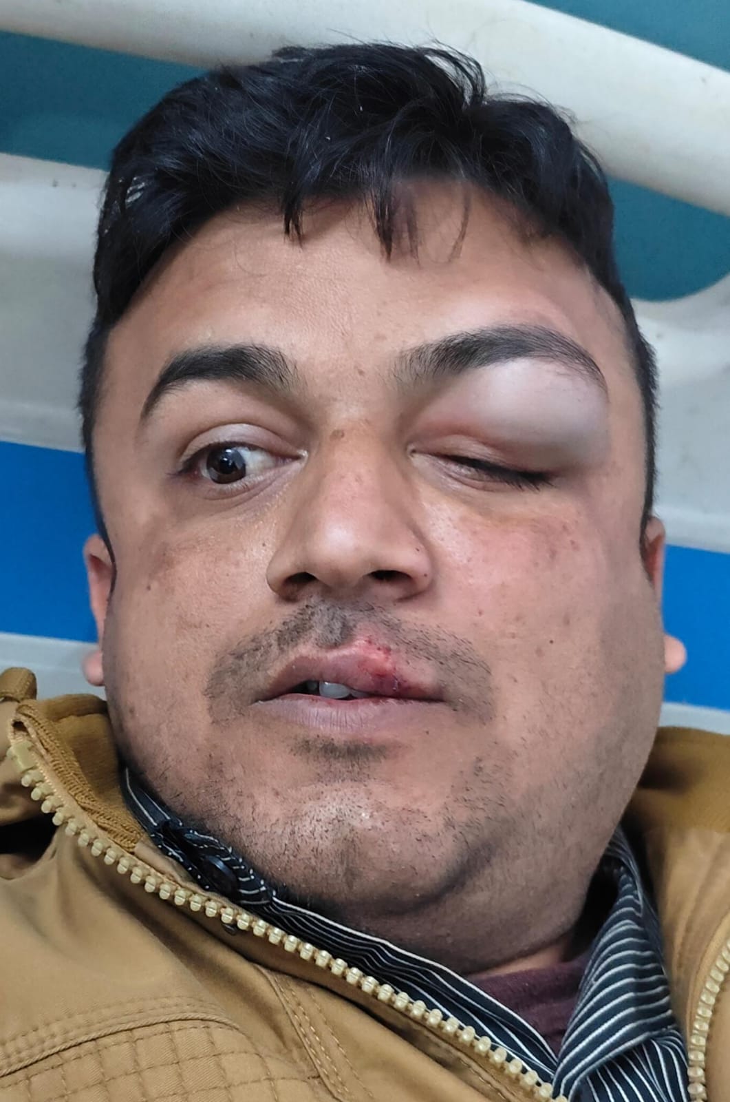 फोटो - 21 ग्रामीणों के कैमरे में कैद तेंदुए की फोटो। स्रोत ग्रामीण