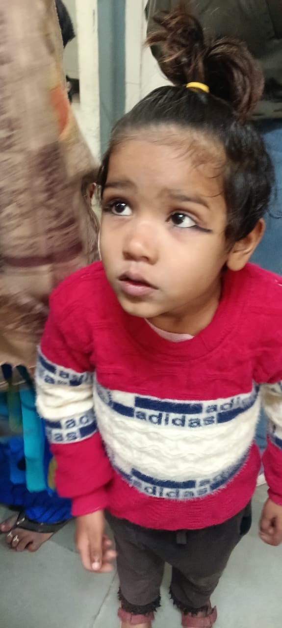 मीरानपुर कटरा में बंदर के काटने से घायल सिद्धार्थ। संवाद