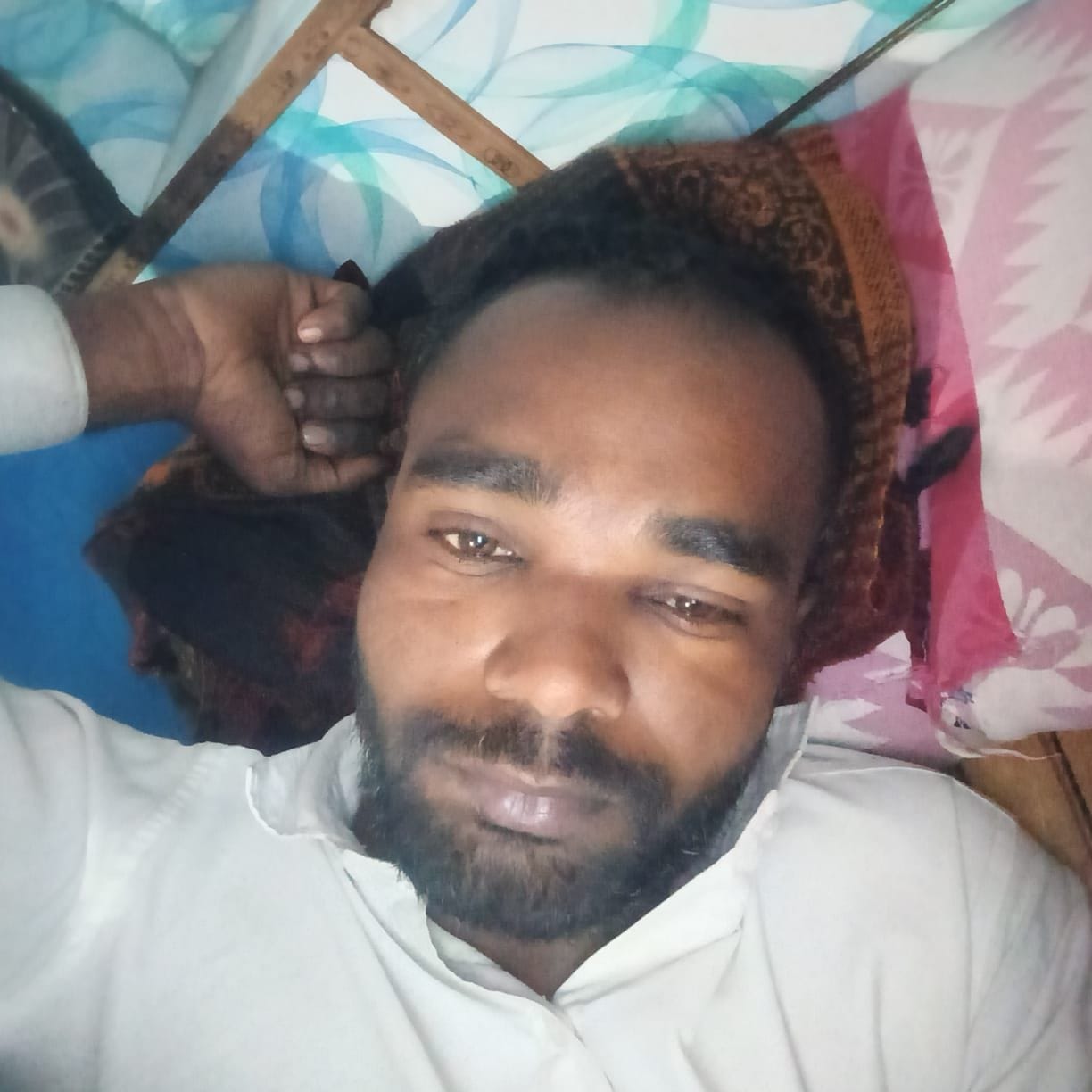मुधमक्खियों के हमले में घायल ग्रामीण। मुधमक्खियों के हमले में घायल ग्रामीण।