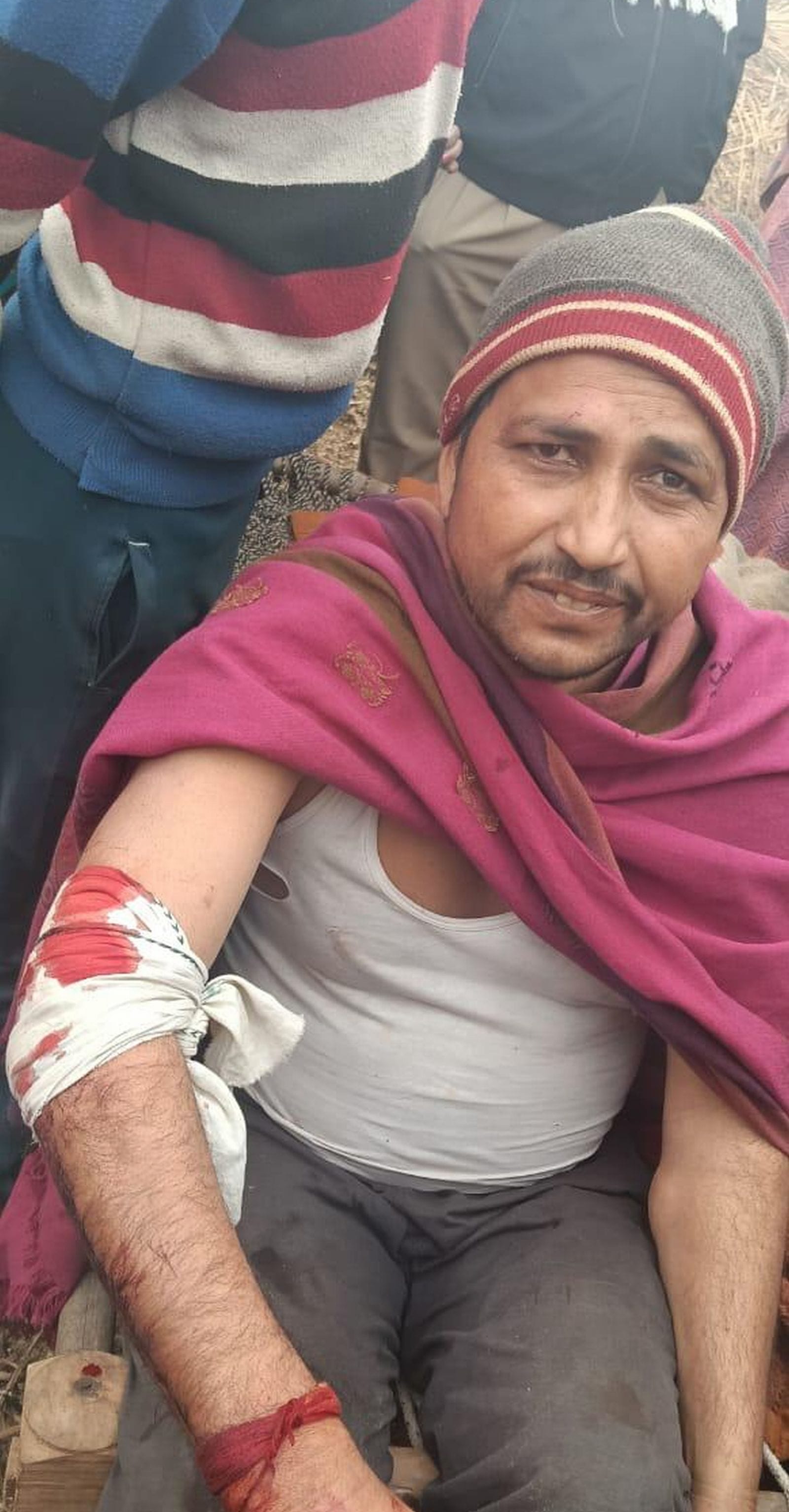 लाठी चार्ज में घायल चंचल व दो अन्य महिलाएं।संवाद लाठी चार्ज में घायल चंचल व दो अन्य महिलाएं।संवाद