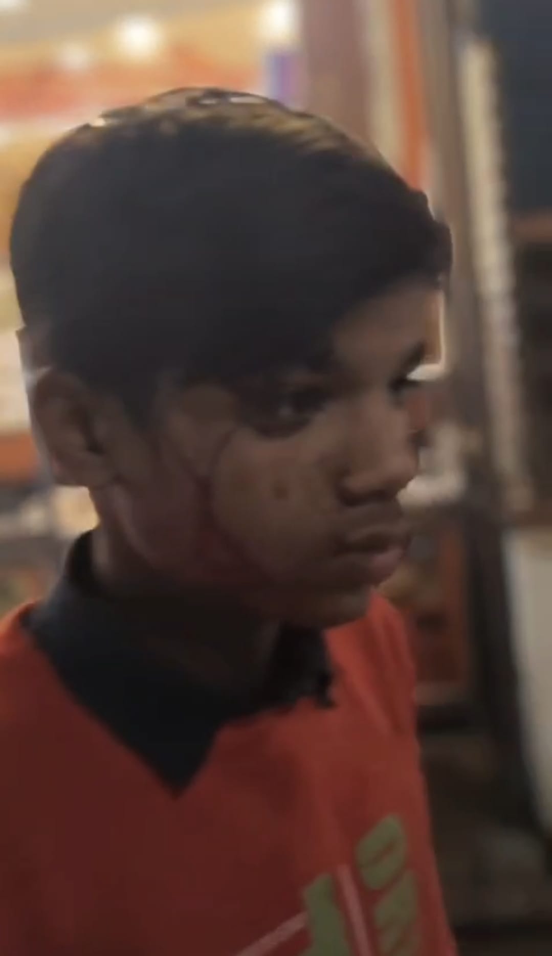 हमले में घायल लोग। हमले में घायल लोग।