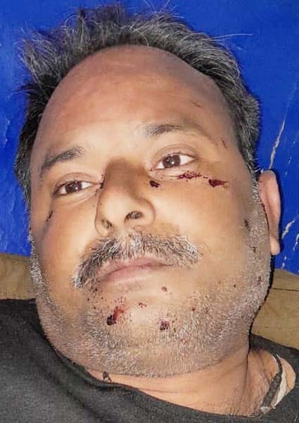 खुटार में यूपी-112 की गाड़ी पलटने से घायल सिपाही अजय कुमार। संवाद खुटार में यूपी-112 की गाड़ी पलटने से घायल सिपाही अजय कुमार। संवाद