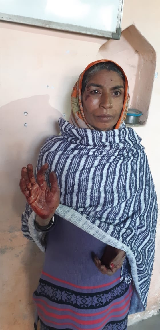 लावड------चिंदौड़ी गांव में तालाब के रास्ते को लेकर हुई मारपीट में घायल