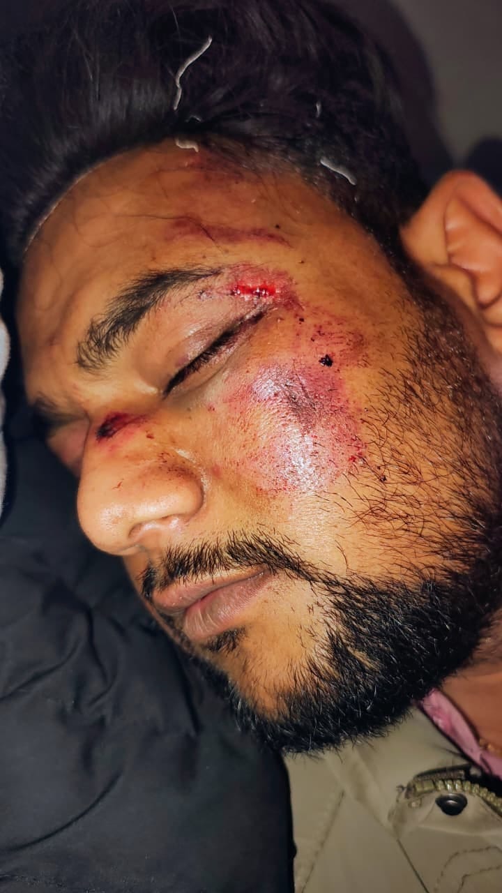 गाड़ी के नीचे दबे पवन की फुटेेज। 