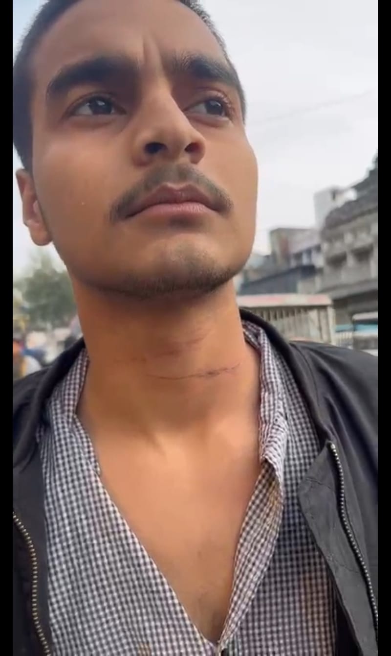 जख्मी प्रिंस। जख्मी प्रिंस।