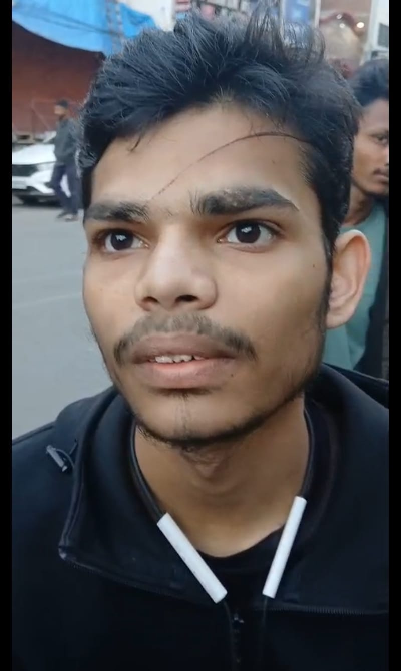 मांझे की चपेट में आने से घायल लोग। 