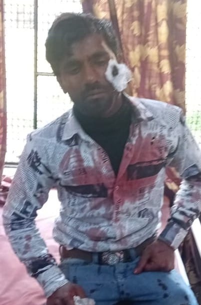 जलालाबाद में हादसे के बाद खड़ी क्षतिग्रस्त कार और भीड़। संवाद जलालाबाद में हादसे के बाद खड़ी क्षतिग्रस्त कार और भीड़। संवाद