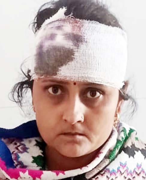 खुटार के पास पलटी स्लीपर बस। संवाद