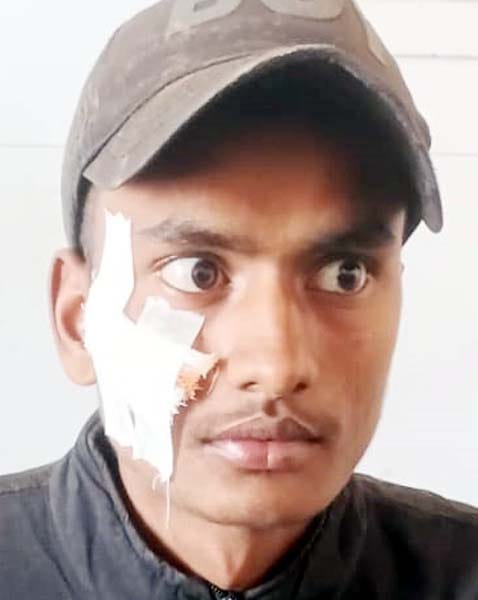खुटार के पास पलटी स्लीपर बस। संवाद खुटार के पास पलटी स्लीपर बस। संवाद