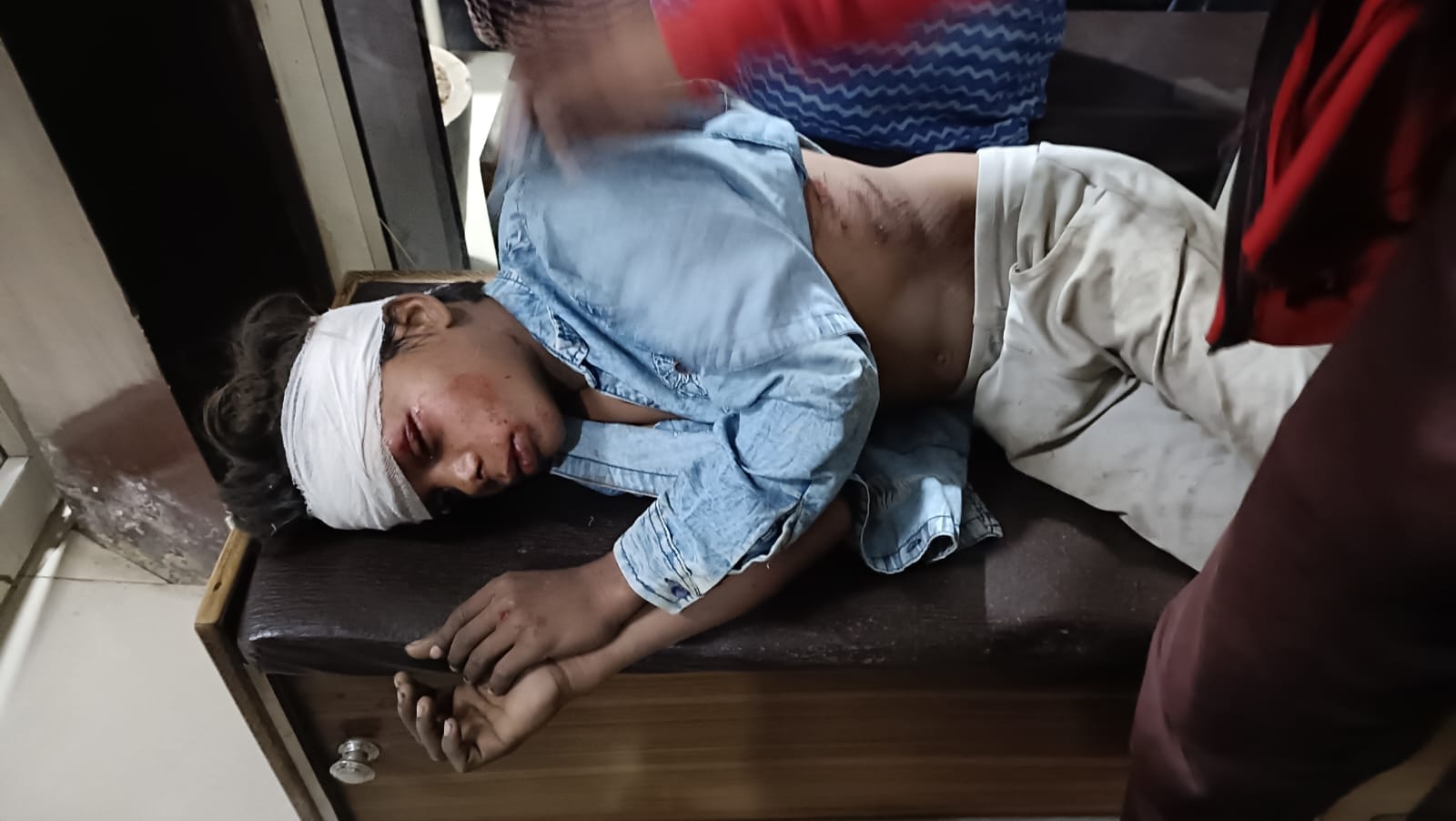 अस्पताल में भर्ती हादसे में घायल लोग। अस्पताल में भर्ती हादसे में घायल लोग।