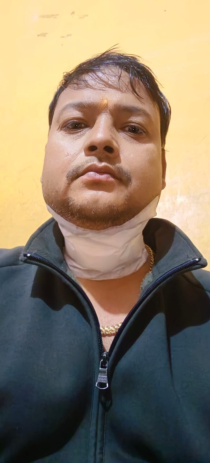 मांझे से कटा युवक का गला।