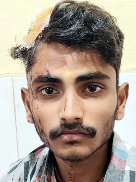 गांव नाहिल में झगड़े में घायल रामप्रकाश शुक्ला। संवाद गांव नाहिल में झगड़े में घायल रामप्रकाश शुक्ला। संवाद