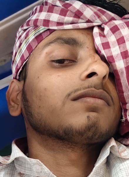 गांव नाहिल में झगड़े में घायल रामप्रकाश शुक्ला। संवाद गांव नाहिल में झगड़े में घायल रामप्रकाश शुक्ला। संवाद