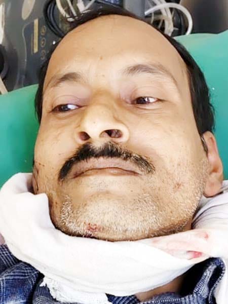 गांव नाहिल में झगड़े में घायल रामप्रकाश शुक्ला। संवाद गांव नाहिल में झगड़े में घायल रामप्रकाश शुक्ला। संवाद