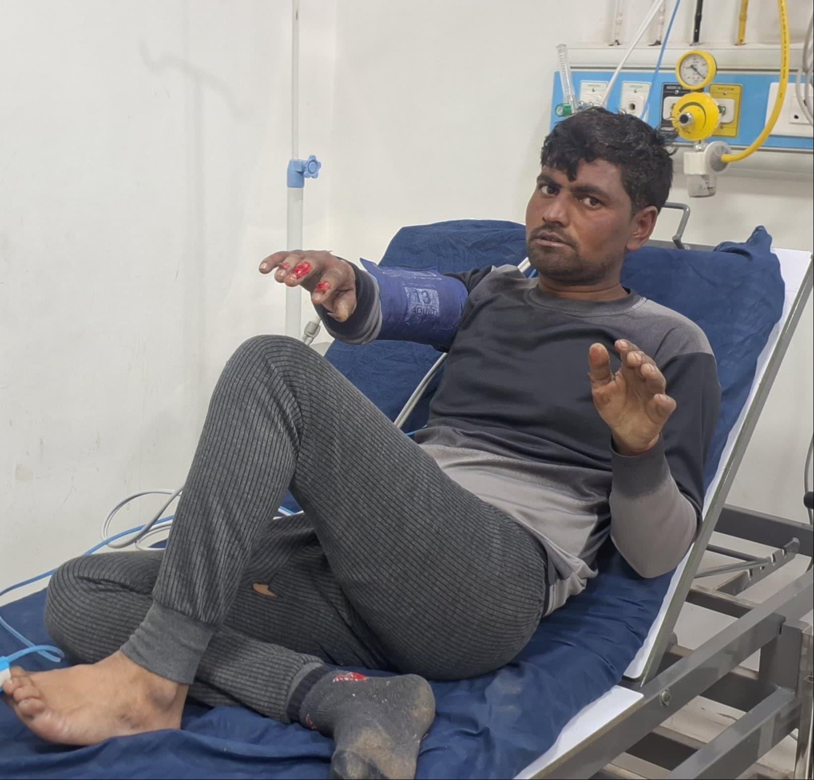 झिंझाना में झुलसे चौकीदार का उपचार करते चिकित्सक । संवाद झिंझाना में झुलसे चौकीदार का उपचार करते चिकित्सक । संवाद