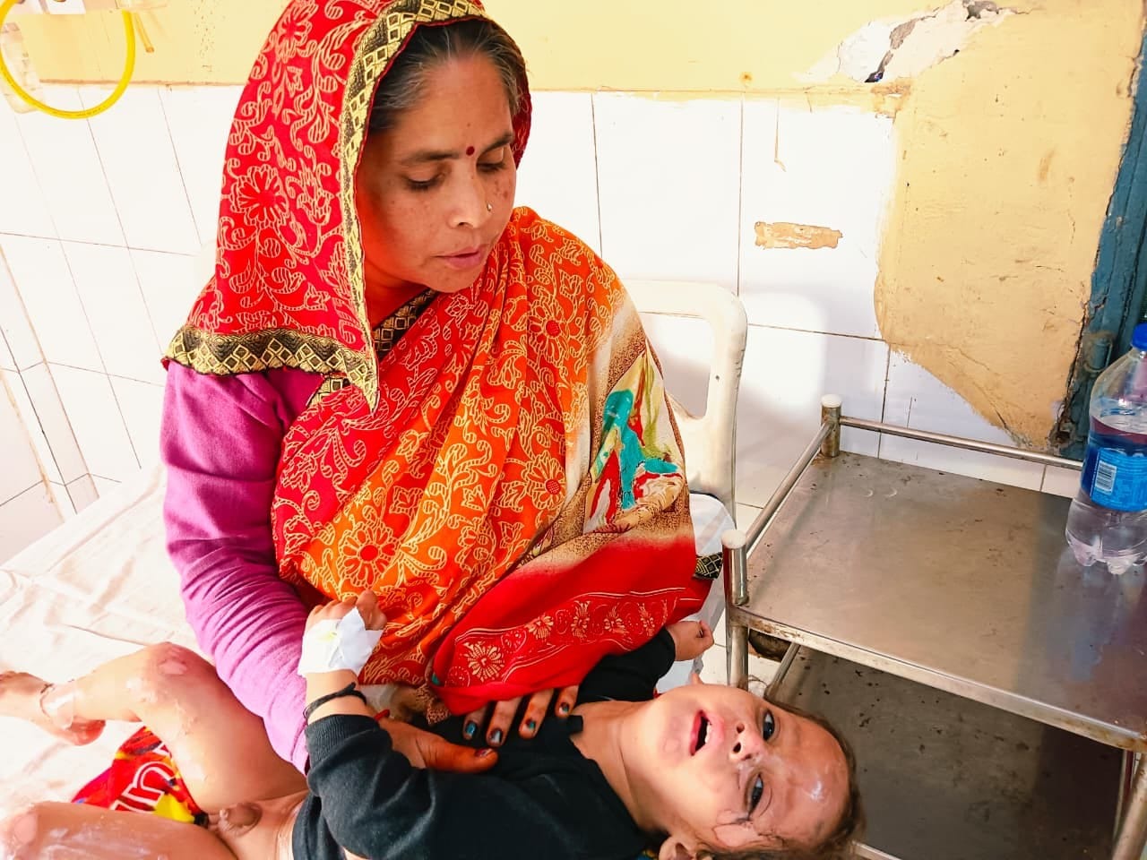 राजकीय मेडिकल कॉलेज में भर्ती आग से झुलसा अनुराग। संवाद राजकीय मेडिकल कॉलेज में भर्ती आग से झुलसा अनुराग। संवाद