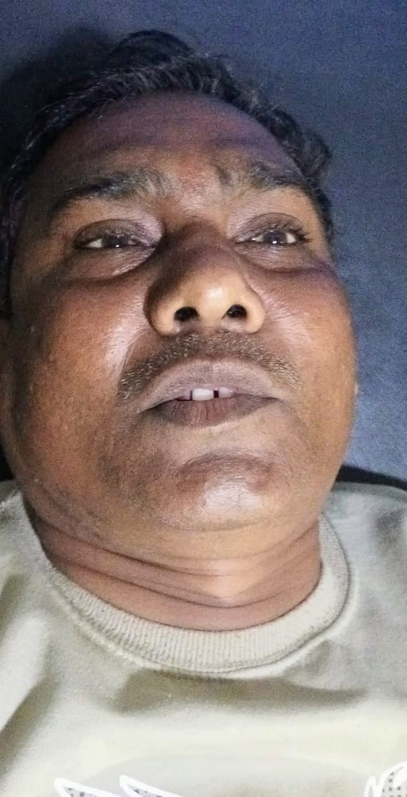 कुट्टू के आटे के सेवन से बीमार हुई सपा नेता नितिन चौहान की मां शर्मिष्ठा। (मवाना) कुट्टू के आटे के सेवन से बीमार हुई सपा नेता नितिन चौहान की मां शर्मिष्ठा। (मवाना)