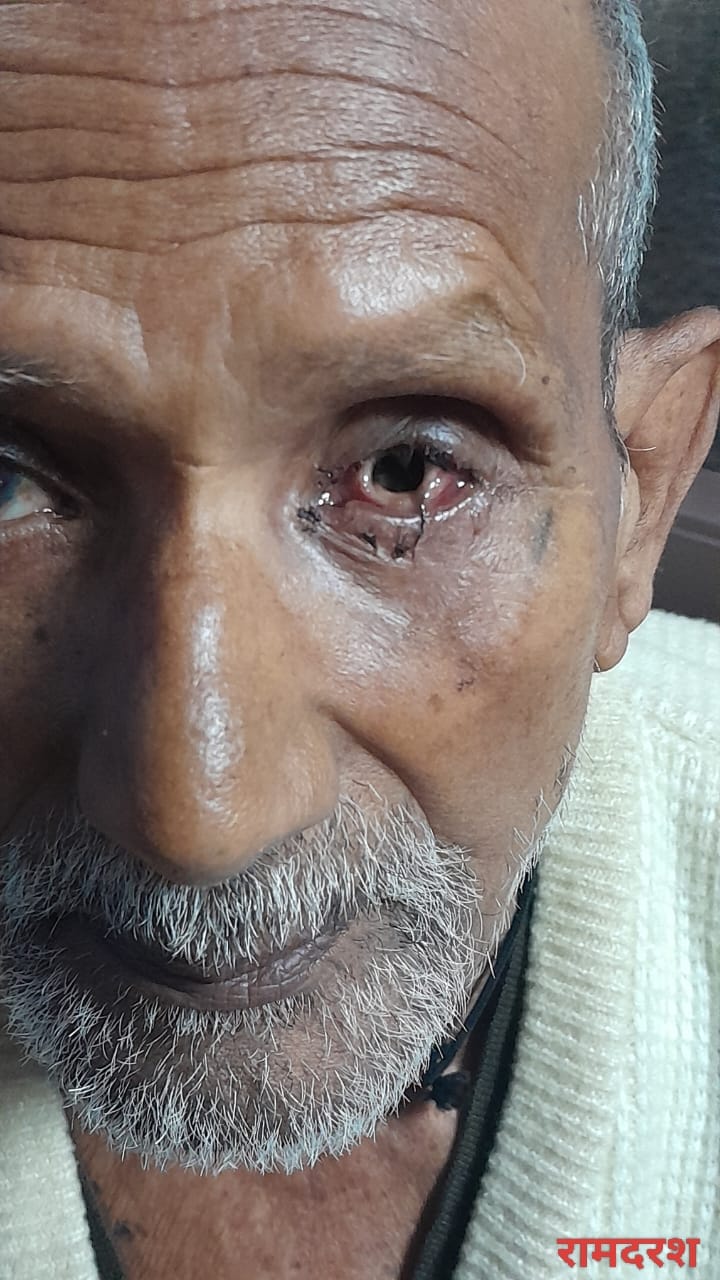 मरीज और परिजन का फोटो - मरीज और परिजन का फोटो -
