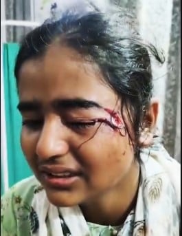 देवबंद में कुत्तों के हमले में घायल अरहम। संवाद