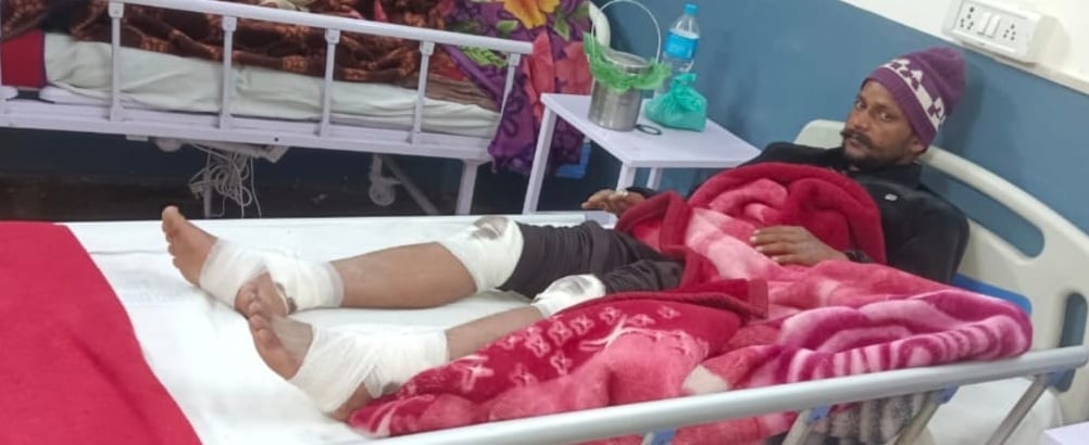 जिला चिकित्सालय में भर्ती करंट से झुलसा युवक। श्रोत ग्रामीण