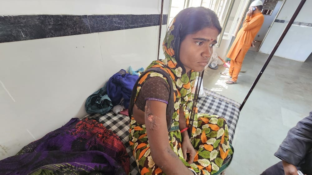 झोपड़ी में लगी आग से 6 माह की मासूम गंभीर रूप से झुलसी, राज्य मंत्री दिलीप अहिरवार के क्षेत्र म