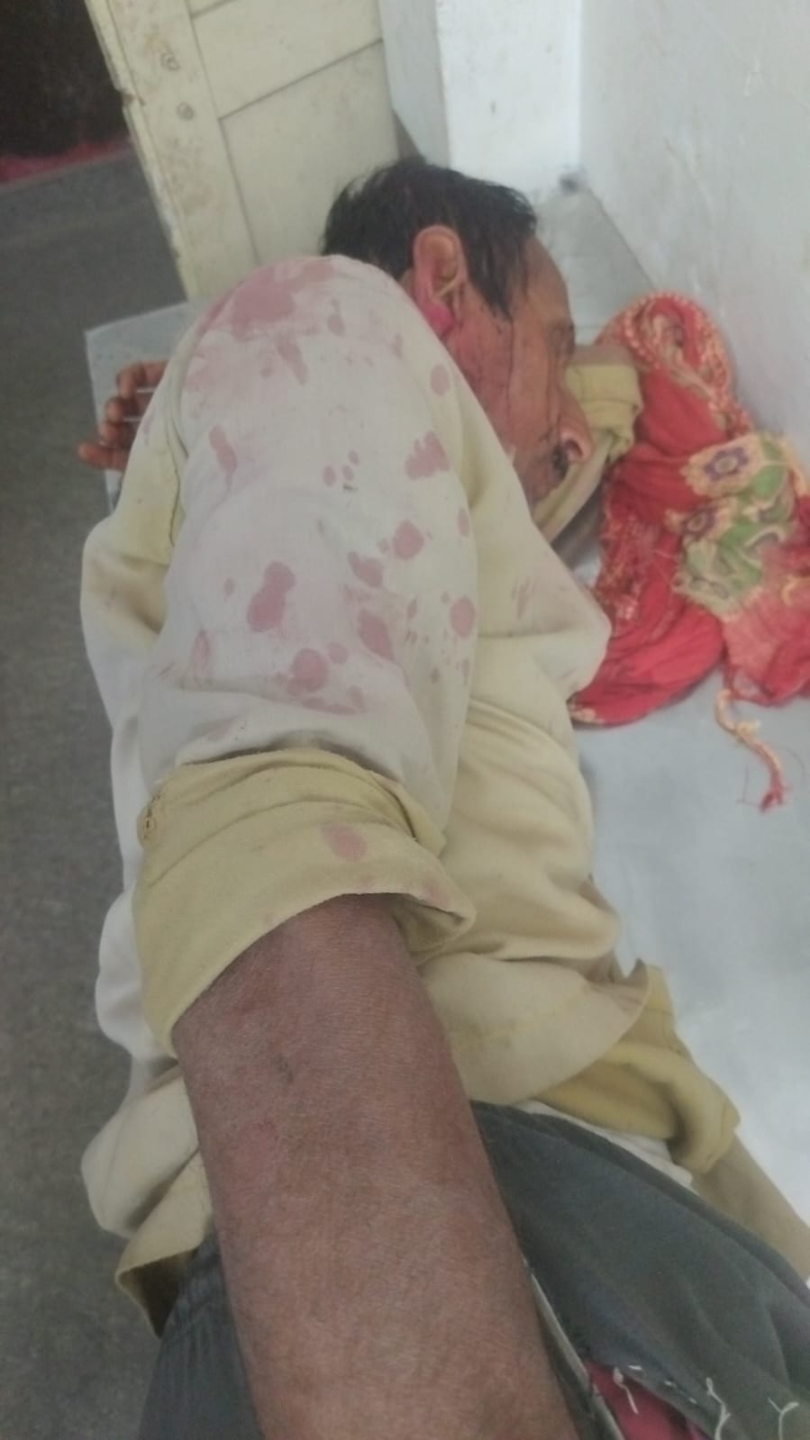 फोटो - 06 चाकू के हमले से घायल इंद्रजीत