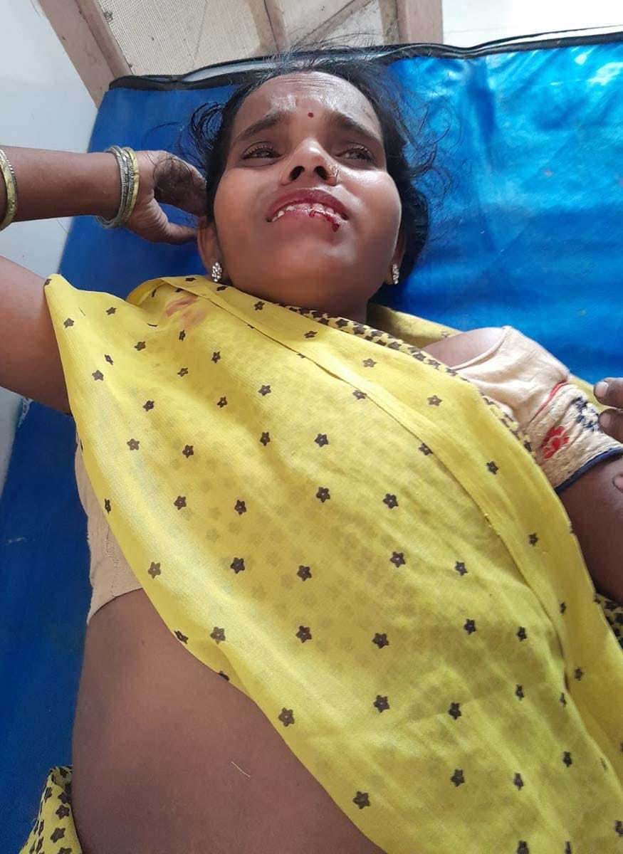 कार की टक्कर से घायल गांव कुर्रैया खानपुर के महेंद्रपाल। संवाद