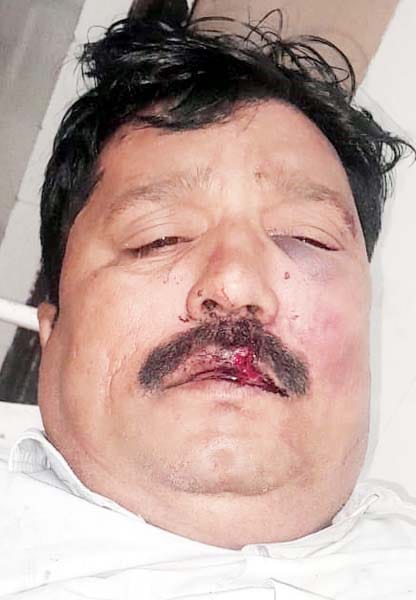 खुटार में हादसे में घायल श्रद्धालुओं को एंबुलेंस से सीएचसी लाते कर्मचारी। संवाद