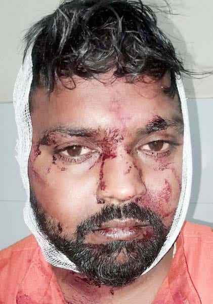 खुटार में हादसे में घायल श्रद्धालुओं को एंबुलेंस से सीएचसी लाते कर्मचारी। संवाद