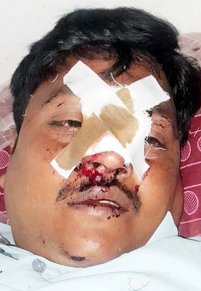 खुटार में हादसे में घायल श्रद्धालुओं को एंबुलेंस से सीएचसी लाते कर्मचारी। संवाद