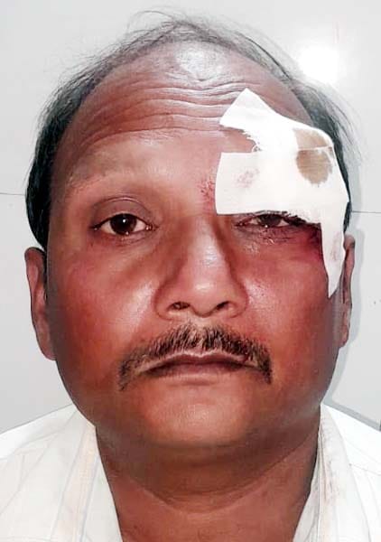 खुटार में हादसे में घायल श्रद्धालुओं को एंबुलेंस से सीएचसी लाते कर्मचारी। संवाद