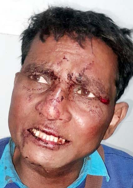 खुटार में हादसे में घायल श्रद्धालुओं को एंबुलेंस से सीएचसी लाते कर्मचारी। संवाद