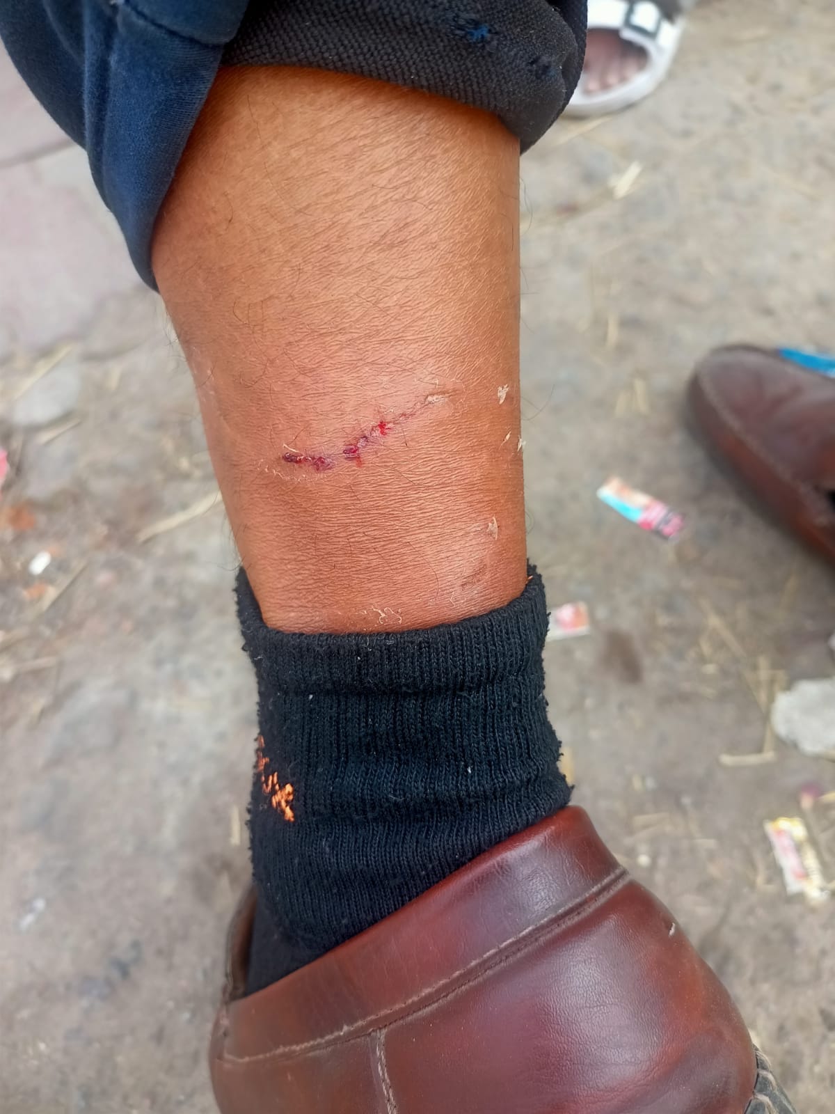 कुत्ते के हमले में जख्मी लोग और कुत्तों को पकड़ने पहुंची टीम। कुत्ते के हमले में जख्मी लोग और कुत्तों को पकड़ने पहुंची टीम।