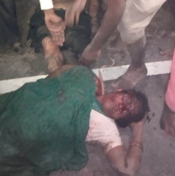 दुर्घटना में घायल श्रद्धालुओ को मेडिकल कॉलेज रेफर ।स्रोत-सोशल मीडिया