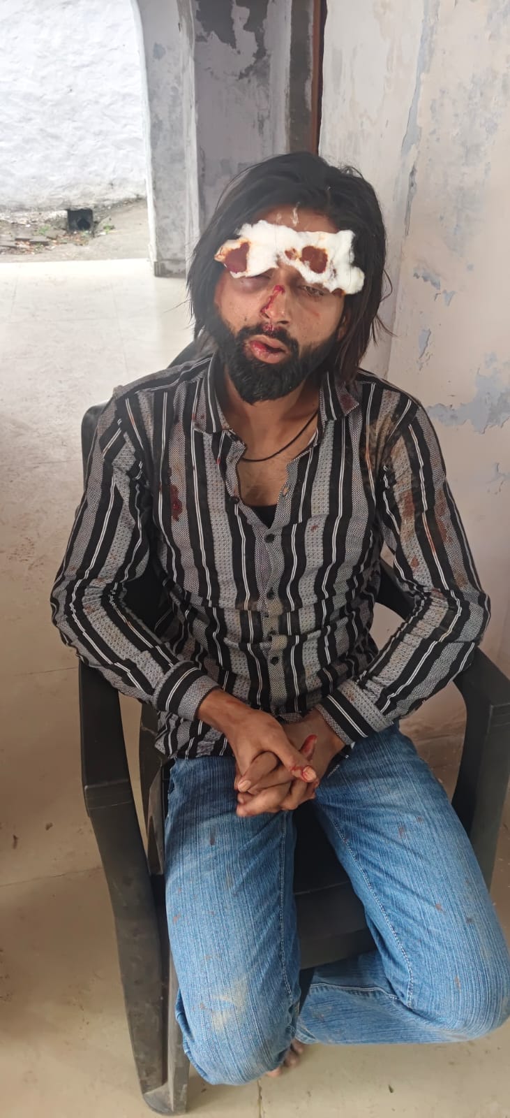 जानीखुर्द। गांव पांचली खुर्द में बरात में हुई मारपीट में घायल युवक फोटो सवांद