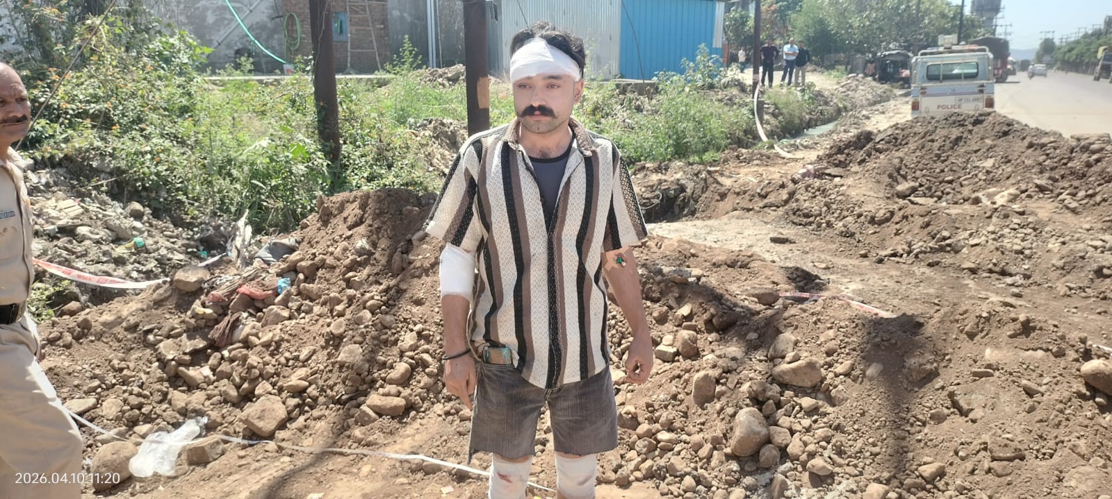 भटोली के निजी अस्पताल में भर्ती सड़क हादसे में घायल अभिषेक भटोली के निजी अस्पताल में भर्ती सड़क हादसे में घायल अभिषेक