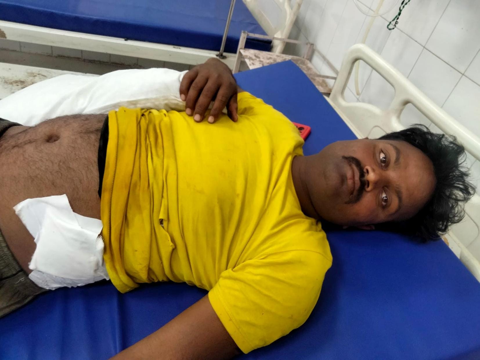 तेंदुए के हमले में घायल आरती।