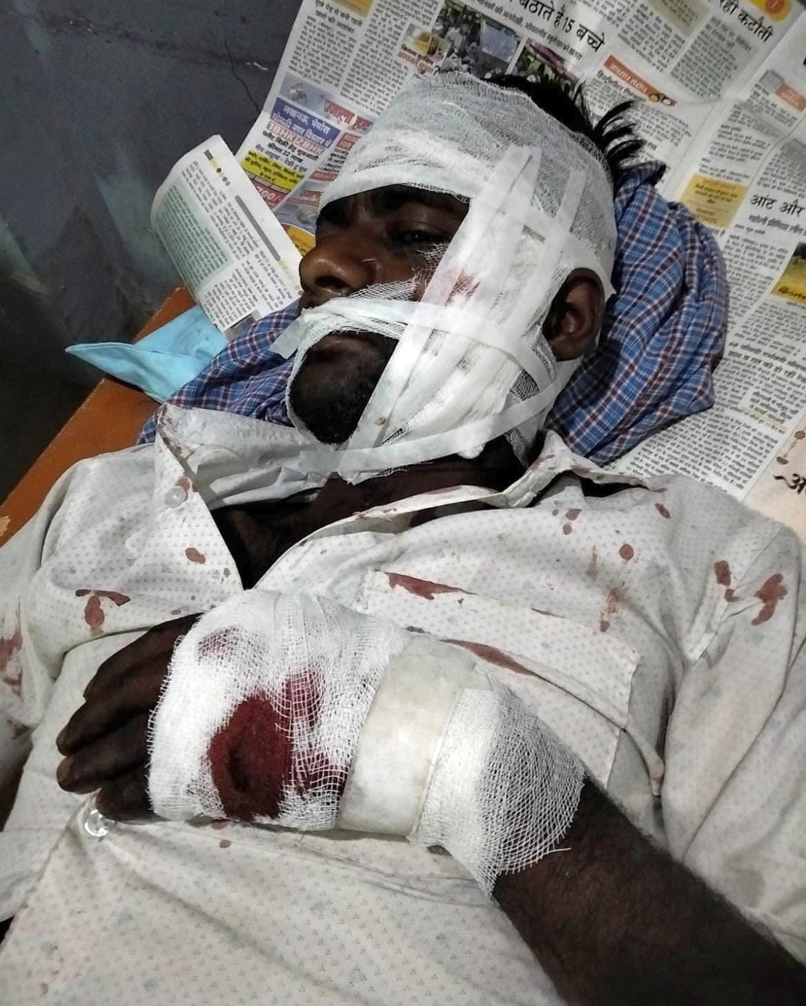 सदरपुर में गोली लगने से घायल सुनील और मौके पर छानबीन करती पुलिस। संवाद