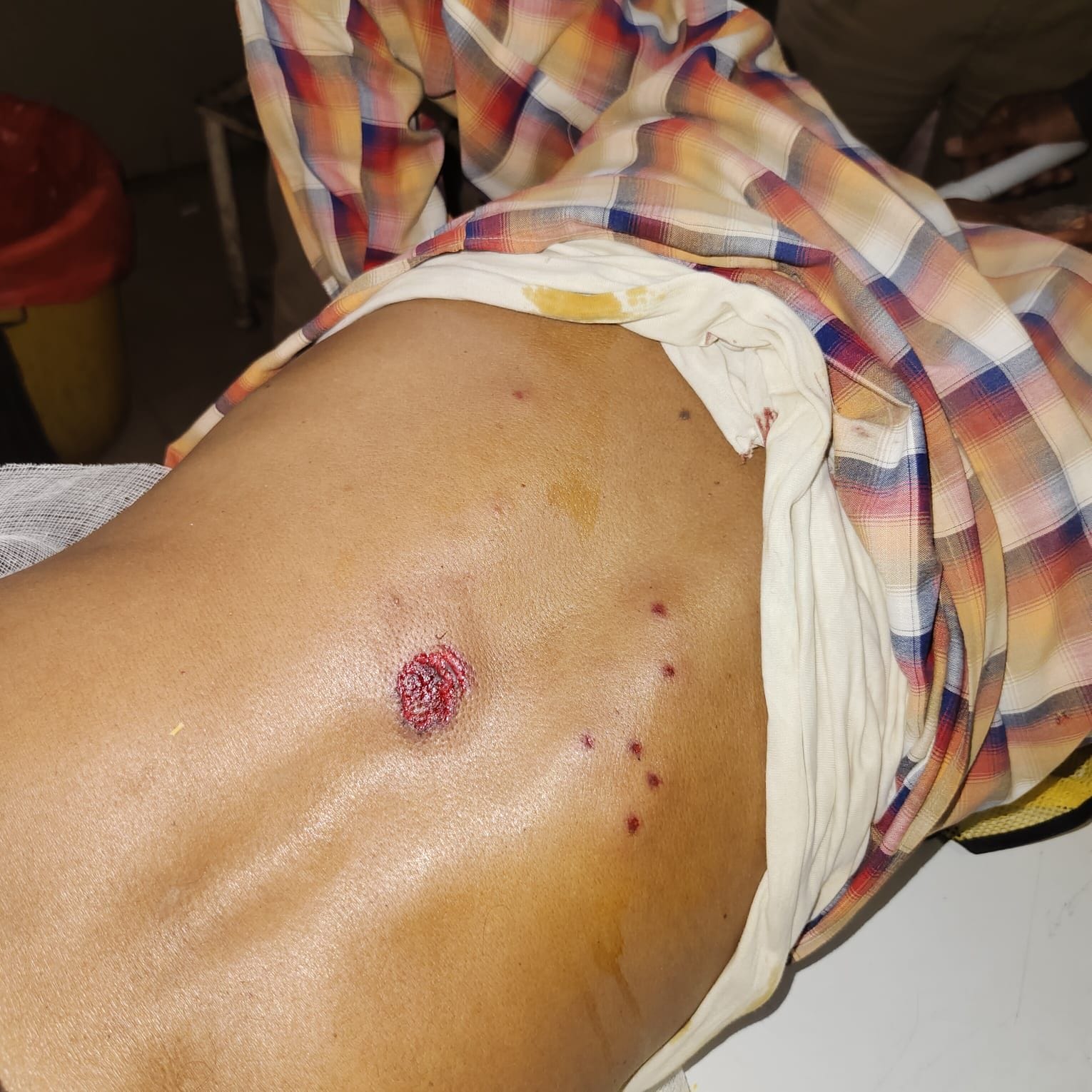 फोटो-10- घायल श्रीकेशन उर्फ शंकर। संवाद