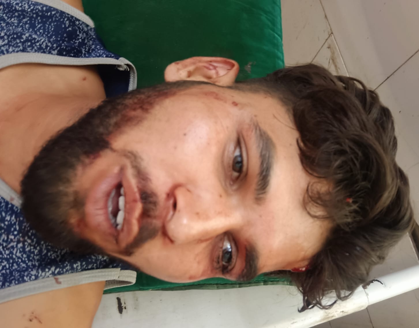 फोटो-6 कायमगंज सीएचसी में बांकेलाल की मौत की सूचना पर हंगामा करतीं महिलाएं। संवाद फोटो-6 कायमगंज सीएचसी में बांकेलाल की मौत की सूचना पर हंगामा करतीं महिलाएं। संवाद