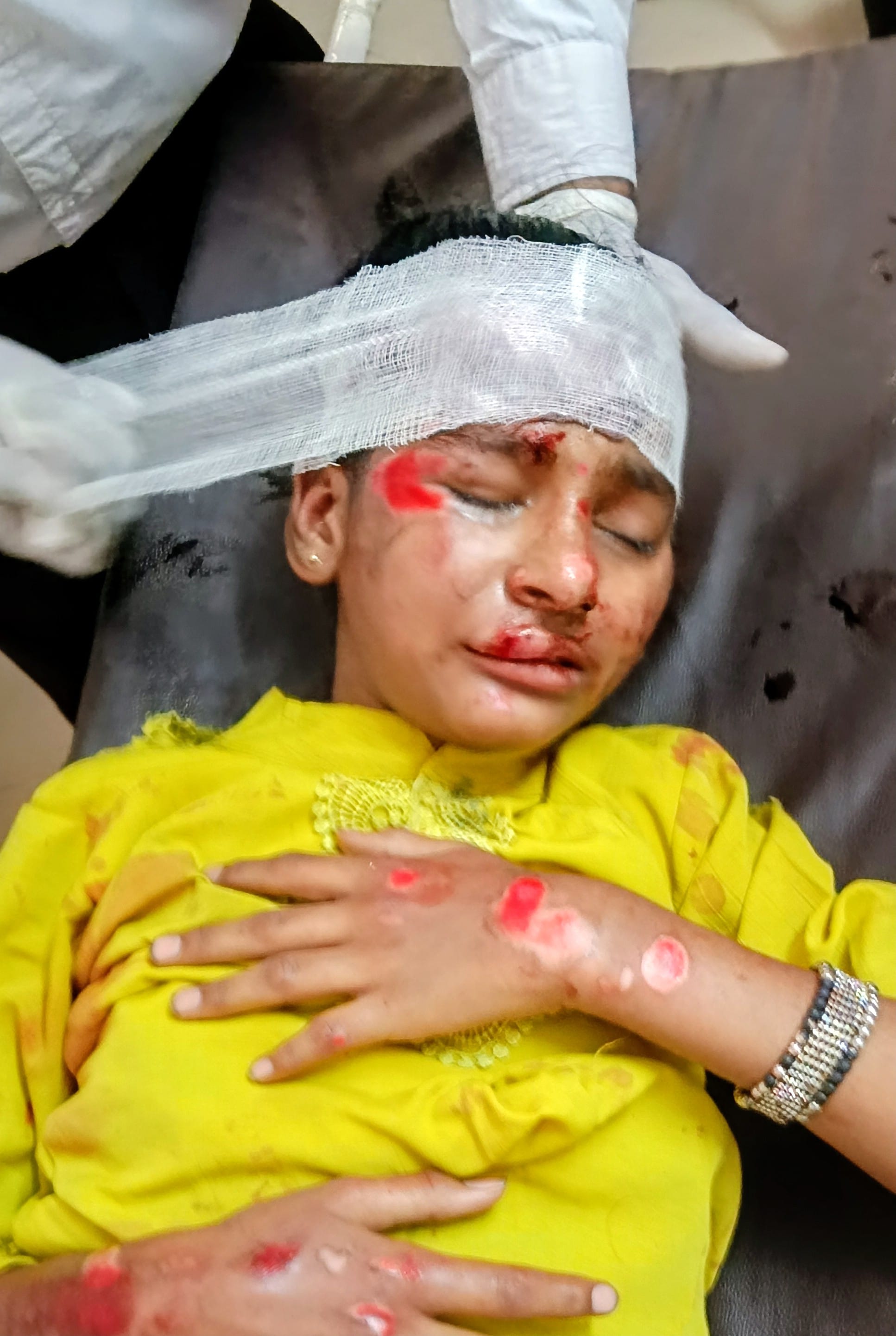 घायल बाइक पर सवार हरबीर निवासी रामराज। (मवाना)