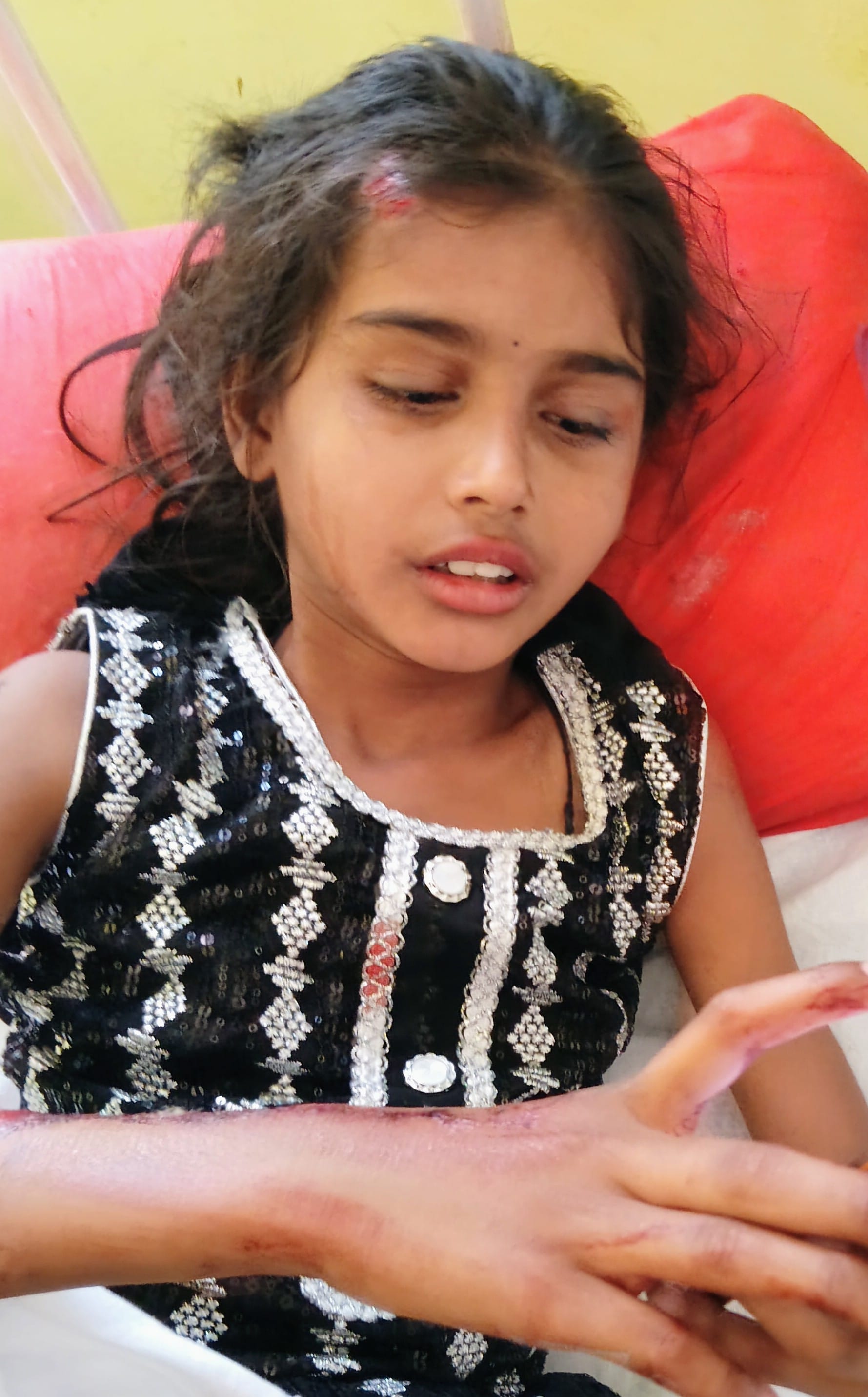 घायल बाइक पर सवार हरबीर निवासी रामराज। (मवाना)